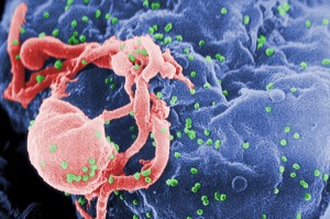 Viriones de VIH-1 (en verde) ensamblándose en la superficie de un linfocito /Wikipedia