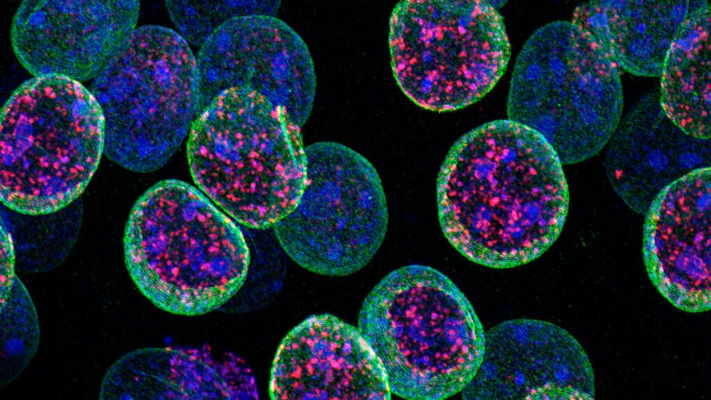 Neuronas CA1 del cerebro de ratones adultos. La modificación epigenética H3K27me3 (en rojo), ADN (en azul) y la proteína de la envoltura nuclear SUN1 fusionada con GFP (en verde). Fuente: Instituto de Neurociencias UMH-CSIC qué es la epigenética