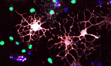 OPCs expuestos a linfocitos T reguladores jóvenes. OPCs (verde) y proteínas de mielina expresadas por los OPCs que se han convertido en oligodendrocitos (rojo y blanco). 
 envejecimiento del cerebro mielina