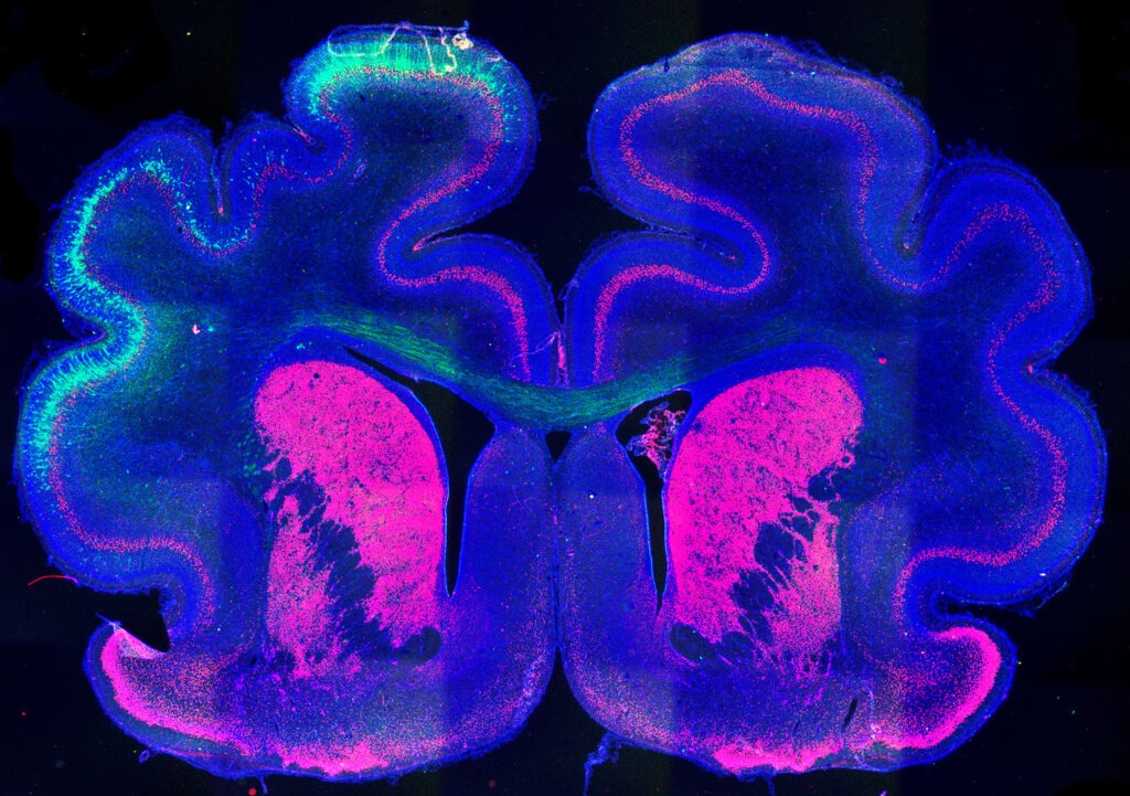por qué se pliega el cerebro. Imagen del cerebro de un hurón que muestra el patrón de plegamiento alterado (izquierda) por mediación de la proteína Cux2.
