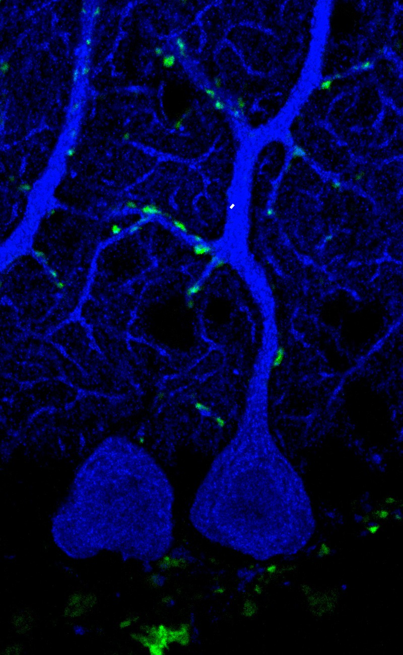 Entender la formación de sinapsis en el cerebelo permitirá crear tratamientos para enfermedades como epilepsia, Parkinson, depresión, esquizofrenia y autismo.