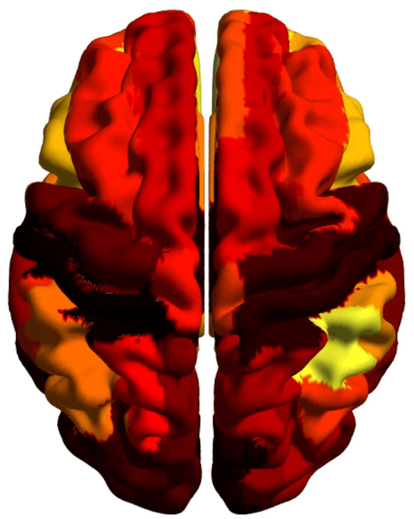 La imagen muestra la distribución jerárquica de conexiones representada en colores sobre la superficie de un cerebro humano.  (arquitectura del cerebro)